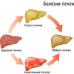 Kako zdraviti cirozo jeter?