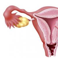Чи можна збільшити та наростити товщину ендометрію до норми при плануванні вагітності для зачаття?